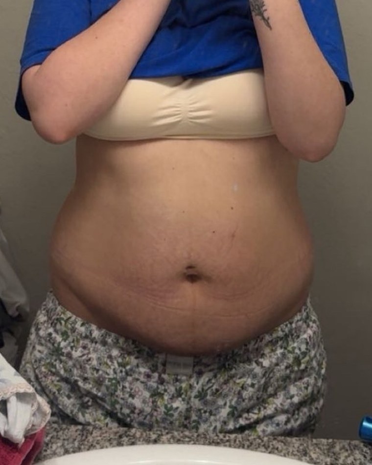 Amanda before